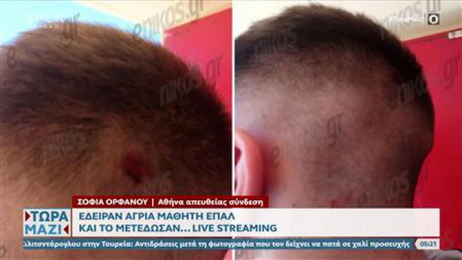 Έ&delta;&epsilon;&iota;&rho;&alpha;&nu; ά&gamma;&rho;&iota;&alpha; &mu;&alpha;&theta;&eta;&tau;ή &Epsilon;&Pi;&Alpha;&Lambda; &kappa;&alpha;&iota; &tau;&omicron; &mu;&epsilon;&tau;έ&delta;&omega;&sigma;&alpha;&nu;...live streaming (vd)