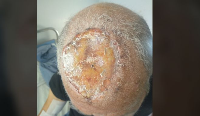 &Pi;&alpha;&nu;&alpha;&rho;&kappa;&alpha;&delta;&iota;&kappa;ό &Nu;&omicron;&sigma;&omicron;&kappa;&omicron;&mu;&epsilon;ί&omicron; | &Alpha;&nu;&tau;&iota;&mu;&epsilon;&tau;&omega;&pi;ί&sigma;&tau;&eta;&kappa;&epsilon; &mu;&epsilon; &epsilon;&pi;&iota;&tau;&upsilon;&chi;ί&alpha; &mu;&epsilon;&gamma;ά&lambda;&omicron; &kappa;&alpha;&rho;&kappa;ί&nu;&omega;&mu;&alpha; &sigma;&tau;&omicron; &kappa;&epsilon;&phi;ά&lambda;&iota; &alpha;&sigma;&theta;&epsilon;&nu;&omicron;ύ&sigmaf;! (&epsilon;&iota;&kappa;ό&nu;&epsilon;&sigmaf;)