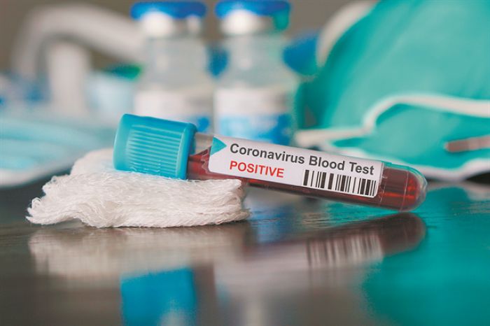 &Kappa;&omicron;&rho;&omega;&nu;&omicron;ϊό&sigmaf; | 217 &nu;έ&alpha; &kappa;&rho;&omicron;ύ&sigma;&mu;&alpha;&tau;&alpha; &sigma;&tau;&eta;&nu; &Epsilon;&lambda;&lambda;ά&delta;&alpha;