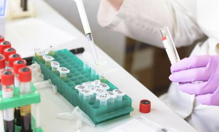 Κορωνοϊός | Ελπιδοφόρα τα αποτελέσματα από τη χρήση κολχικίνης σε 60 Έλληνες ασθενείς