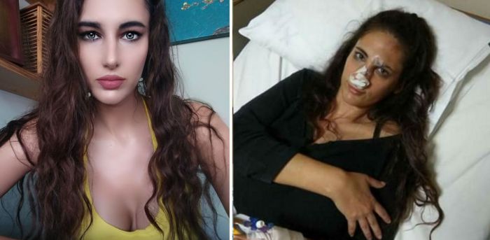 &Theta;ύ&mu;&alpha; &xi;&upsilon;&lambda;&omicron;&delta;&alpha;&rho;&mu;&omicron;ύ &sigma;&tau;&omicron; &Nu;&alpha;ύ&pi;&lambda;&iota;&omicron; έ&pi;&epsilon;&sigma;&epsilon; &tau;&omicron; &mu;&omicron;&nu;&tau;έ&lambda;&omicron; &Nu;&alpha;&sigma;&tau;ά&zeta;&iota;&alpha; &Mu;&eta;&tau;&rho;&omicron;&pi;&omicron;ύ&lambda;&omicron;&upsilon; (&epsilon;&iota;&kappa;ό&nu;&epsilon;&sigmaf;)