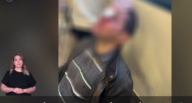 Επίθεση κουκουλοφόρων στη Νομική – Χτυπούσαν τον φοιτητή με κράνη και γκλοπ - Αίματα στο πάτωμα (vd)