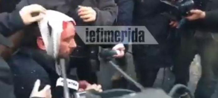 &Sigma;&omicron;&kappa;ά&rho;&epsilon;&iota; &eta; &mu;&alpha;&rho;&tau;&upsilon;&rho;ί&alpha; &phi;&omega;&tau;&omicron;&rho;&epsilon;&pi;ό&rho;&tau;&epsilon;&rho; | "&Epsilon;ί&chi;&alpha;&mu;&epsilon; &pi;έ&sigma;&epsilon;&iota; &kappa;ά&tau;&omega;, &mu;&alpha;&sigmaf; &beta;ά&rho;&alpha;&gamma;&alpha;&nu; &mu;&epsilon; &rho;ό&pi;&alpha;&lambda;&alpha;, &kappa;&lambda;&omega;&tau;&sigma;&iota;έ&sigmaf;, &mu;&pi;&omicron;&upsilon;&nu;&iota;έ&sigmaf;" (vd)