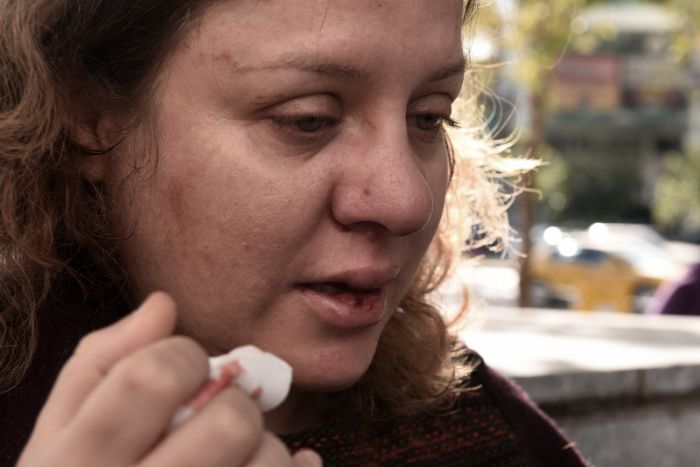 Δύο γυναίκες καταγγέλλουν επίθεση από Χρυσαυγίτες - Προσήχθησαν 25 άτομα στη ΓΑΔΑ