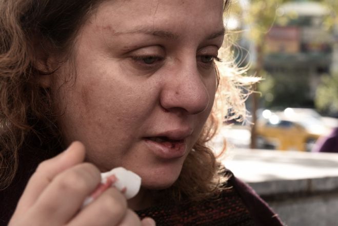 Δύο γυναίκες καταγγέλλουν επίθεση από Χρυσαυγίτες - Προσήχθησαν 25 άτομα στη ΓΑΔΑ