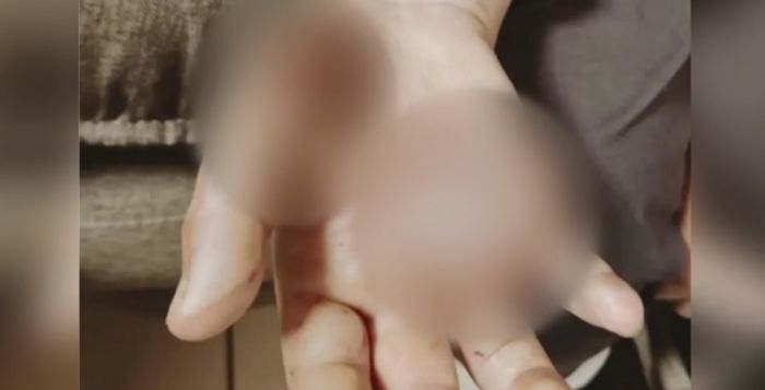 &Nu;έ&alpha; &Sigma;&mu;ύ&rho;&nu;&eta; | &Beta;ί&alpha;&zeta;&epsilon; &kappa;&alpha;&iota; &beta;&alpha;&sigma;ά&nu;&iota;&zeta;&epsilon; &tau;&eta; 10&chi;&rho;&omicron;&nu;&eta; &kappa;ό&rho;&eta; &tau;&omicron;&upsilon; -&Tau;&eta;&nu; έ&kappa;&alpha;&iota;&gamma;&epsilon; &sigma;&tau;&omicron; &ldquo;&mu;ά&tau;&iota;&rdquo; &tau;&eta;&sigmaf; &kappa;&omicron;&upsilon;&zeta;ί&nu;&alpha;&sigmaf; (vd)