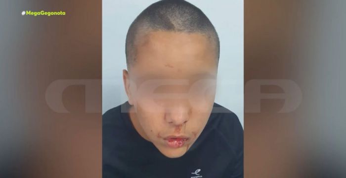 Άγριος ξυλοδαρμός 13χρονου από 16χρονο στην Ελλάδα - Σοκάρουν οι εικόνες (vd)