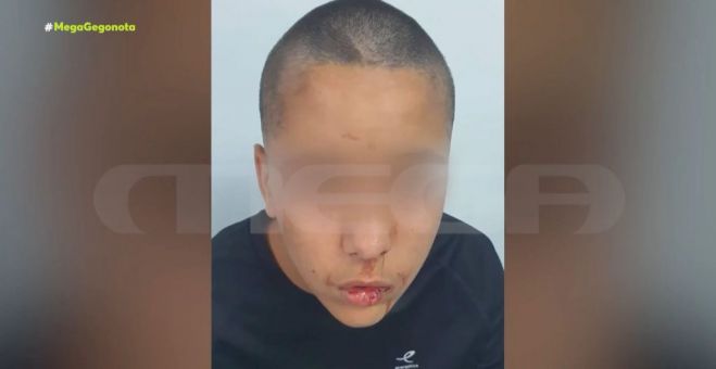 Άγριος ξυλοδαρμός 13χρονου από 16χρονο στην Ελλάδα - Σοκάρουν οι εικόνες (vd)