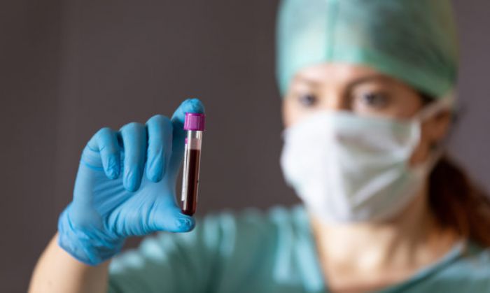 &Pi;&omicron;&iota;&alpha; &omicron;&mu;ά&delta;&alpha; &alpha;ί&mu;&alpha;&tau;&omicron;&sigmaf; &kappa;&iota;&nu;&delta;&upsilon;&nu;&epsilon;ύ&epsilon;&iota; &lambda;&iota;&gamma;ό&tau;&epsilon;&rho;&omicron; &alpha;&pi;ό &tau;&omicron;&nu; &nu;έ&omicron; &kappa;&omicron;&rho;&omega;&nu;&omicron;ϊό