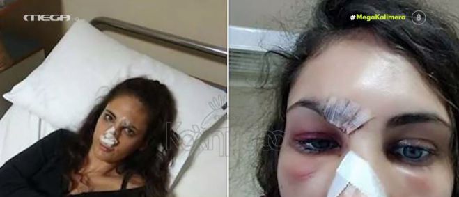 &Nu;&alpha;&sigma;&tau;ά&zeta;&iota;&alpha; &Mu;&eta;&tau;&rho;&omicron;&pi;&omicron;ύ&lambda;&omicron;&upsilon;: "&Kappa;ό&nu;&tau;&epsilon;&psi;&alpha; &nu;&alpha; &mu;&epsilon;ί&nu;&omega; &pi;&alpha;&rho;ά&lambda;&upsilon;&tau;&eta; &alpha;&pi;ό &tau;&eta;&nu; &kappa;&alpha;&kappa;&omicron;&pi;&omicron;ί&eta;&sigma;&eta; &tau;&omicron;&upsilon; &pi;&rho;ώ&eta;&nu; &sigma;&upsilon;&nu;&tau;&rho;ό&phi;&omicron;&upsilon; &mu;&omicron;&upsilon;" (vd)