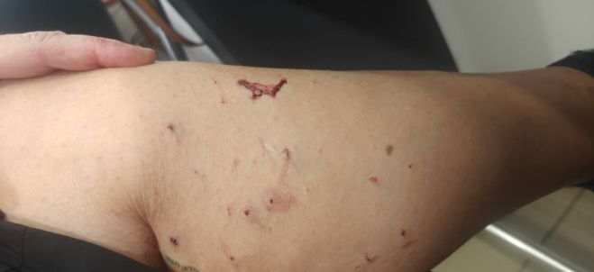 &Kappa;&alpha;&tau;&alpha;&gamma;&gamma;&epsilon;&lambda;ί&alpha; &gamma;&iota;&alpha; &epsilon;&pi;ί&theta;&epsilon;&sigma;&eta; &gamma;ά&tau;&alpha;&sigmaf; &sigma;&epsilon; &gamma;&upsilon;&nu;&alpha;ί&kappa;&alpha; &sigma;&tau;&eta;&nu; &Tau;&rho;ί&pi;&omicron;&lambda;&eta;