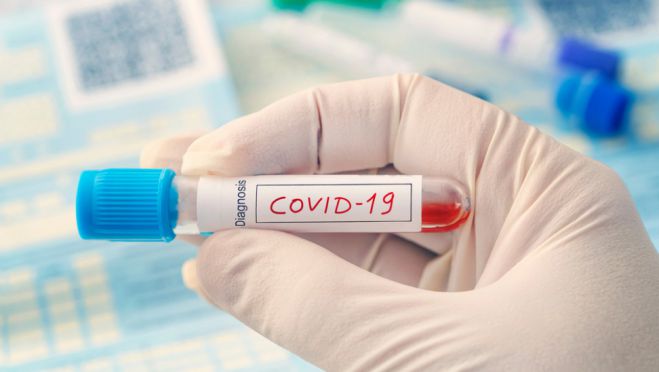 Υποχρεωτικά τα τεστ κορωνοϊού COVID-19 για τους εκπαιδευτικούς