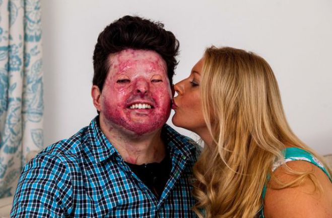 Έ&gamma;&iota;&nu;&epsilon; &theta;ύ&mu;&alpha; &epsilon;&pi;ί&theta;&epsilon;&sigma;&eta;&sigmaf; &mu;&epsilon; &omicron;&xi;ύ &alpha;&pi;ό &lambda;ά&theta;&omicron;&sigmaf; &kappa;&alpha;&iota; &sigma;&tau;έ&lambda;&nu;&epsilon;&iota; &mu;ή&nu;&upsilon;&mu;&alpha; &sigma;&tau;&eta;&nu; &Iota;&omega;ά&nu;&nu;&alpha; &Pi;&alpha;&lambda;&iota;&omicron;&sigma;&pi;ύ&rho;&omicron;&upsilon; (vd)