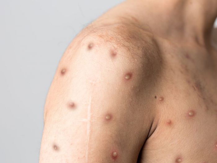 &Epsilon;&pi;&tau;ά &kappa;&rho;&omicron;ύ&sigma;&mu;&alpha;&tau;&alpha; "&epsilon;&upsilon;&lambda;&omicron;&gamma;&iota;ά&sigmaf; &tau;&omega;&nu; &pi;&iota;&theta;ή&kappa;&omega;&nu;" &sigma;&tau;&eta;&nu; &Epsilon;&lambda;&lambda;ά&delta;&alpha;