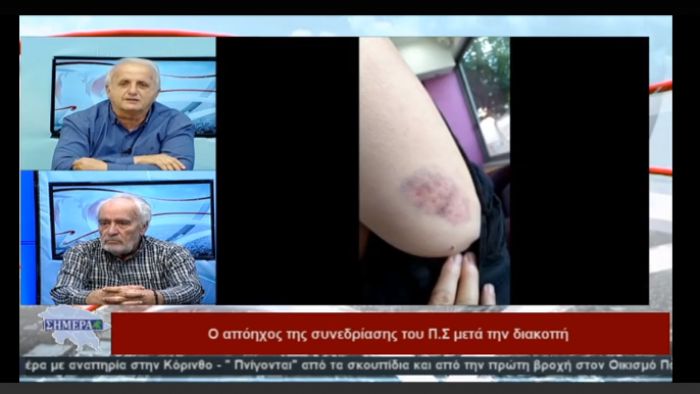 &Kappa;&iota;&nu;&epsilon;ί&tau;&alpha;&iota; &nu;&omicron;&mu;&iota;&kappa;ά &omicron; &Theta;. &Kappa;ά&pi;&pi;&omicron;&sigmaf; &tau;&omicron;&upsilon; Super &gamma;&iota;&alpha; &tau;&omicron; &epsilon;&pi;&epsilon;&iota;&sigma;ό&delta;&iota;&omicron; &sigma;&tau;&omicron; &pi;&epsilon;&rho;&iota;&phi;&epsilon;&rho;&epsilon;&iota;&alpha;&kappa;ό &sigma;&upsilon;&mu;&beta;&omicron;ύ&lambda;&iota;&omicron; (vd)