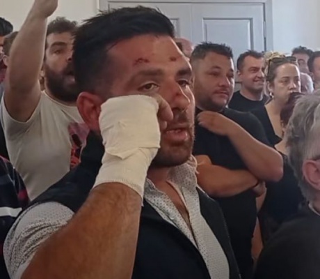«Αν είχα χτυπήσει σοβαρά, τι θα είχε συμβεί;» – Η κραυγή αγωνίας κατοίκου της Γορτυνίας για το άθλιο οδικό δίκτυο και τη διακομιδή ασθενών (vd)