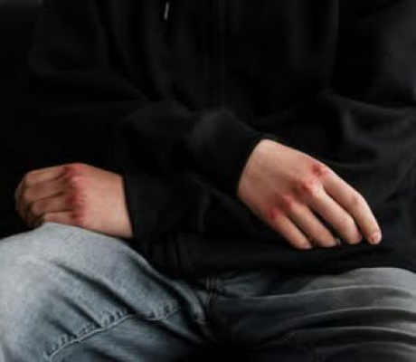 Τουλάχιστον ένα στα έξι παιδιά αυτοτραυματίζεται στην Ελλάδα!