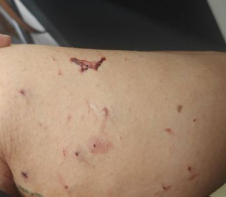 Καταγγελία για επίθεση γάτας σε γυναίκα στην Τρίπολη