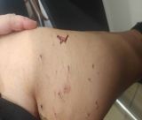 Καταγγελία για επίθεση γάτας σε γυναίκα στην Τρίπολη