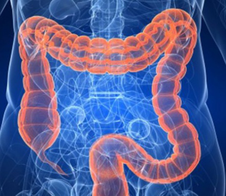 Ενημερωτική ομιλία για τον Καρκίνο του Παχέος Εντέρου στο ΚΑΠΗ του Δήμου Τρίπολης